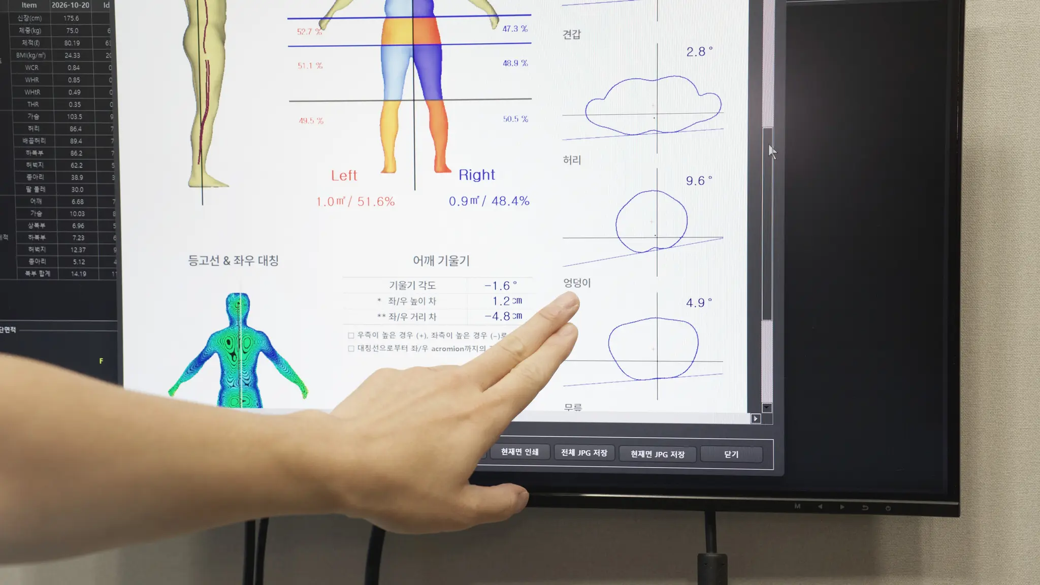 3D 바디 스캔 결과 화면의 자세 분석 그림을 손으로 가리키는 모습